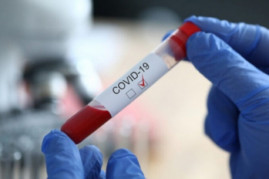 Коронавирус в Днепре: последняя информация о заболевших на 2 января Коронавирус в Днепре: последняя информация о заболевших на 2 января