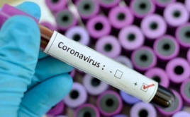 Каменское стало «лидером» по коронавирусу в области