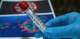 На Днепропетровщине 47 заболевших коронавирусом за сутки
