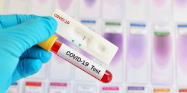 Названий термін збереження антитіл до COVID-19 в організмі