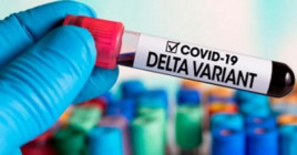Днепропетровской области закупят тесты для выявления Дельта–коронавируса