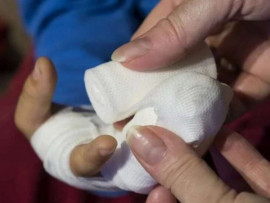 Из-за неосторожного обращения с пиротехникой житель Днепра потерял палец Из-за неосторожного обращения с пиротехникой житель Днепра потерял палец