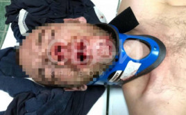 На Днепропетровщине мужчина выпал с 10 этажа (фото +18) На Днепропетровщине мужчина выпал с 10 этажа (фото +18)
