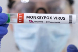 В Україні зареєстрували четвертий випадок мавпячої віспи: чи можлива епідемія В Україні зареєстрували четвертий випадок мавпячої віспи: чи можлива епідемія