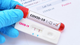 Статистика COVID-19: понад 20 тисяч нових випадків за добу та 725 померлих