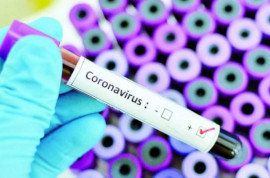 В Украине создали тесты для выявления коронавируса. Они в пять раз дешевле немецких