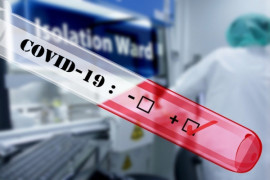 77 жителей Днепропетровщины проверили на коронавирус
