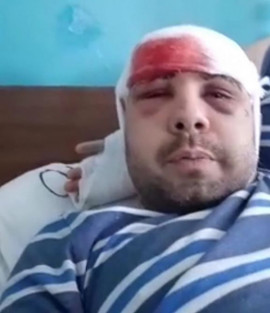 ЗА ЩО нападають на тих, хто проти можновладців Кам’янського ЗА ЩО нападають на тих, хто проти можновладців Кам’янського
