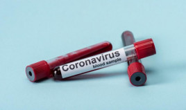 На Днепропетровщине пик заболеваемости коронавирусом прогнозируют на середину мая
