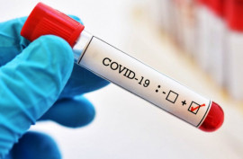 За сутки в Днепропетровской области обнаружили 7 новых случаев коронавирусной болезни