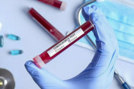 В МОЗ напомнили, кому бесплатно делают тесты на COVID-19 В МОЗ напомнили, кому бесплатно делают тесты на COVID-19